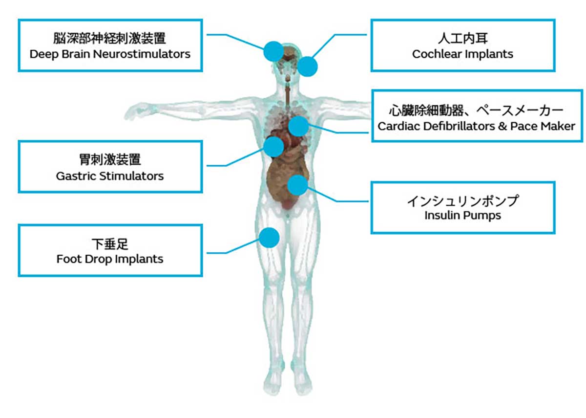 インプラント型医療機器（GCH/GCRシリーズ）のイメージ画像2