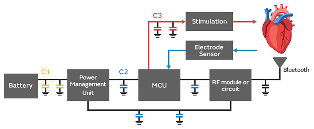 Image of Solution for Pace Maker