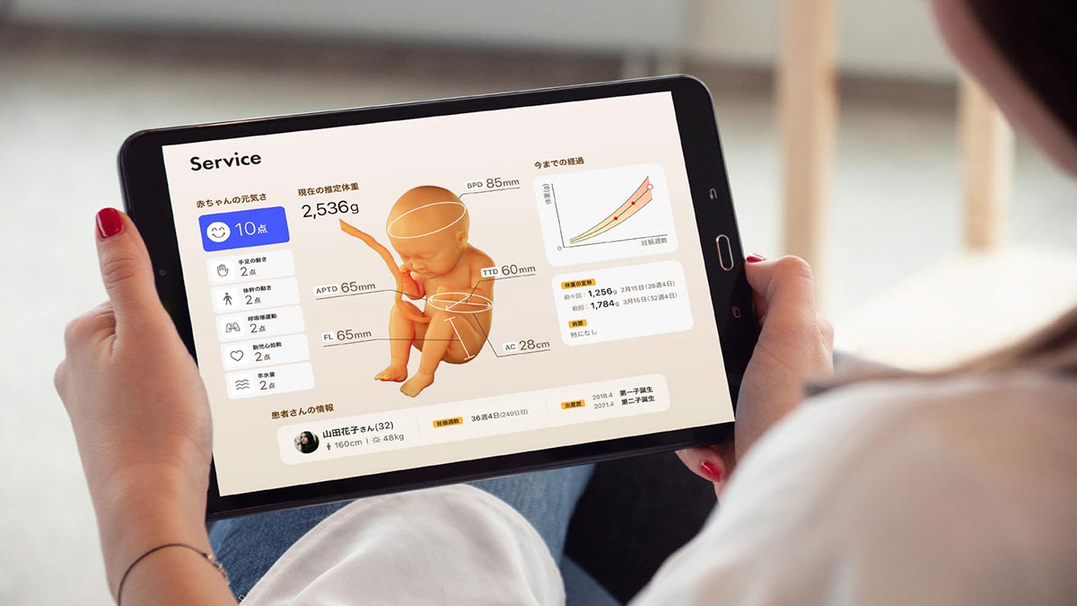 Concept image of monitoring with this system